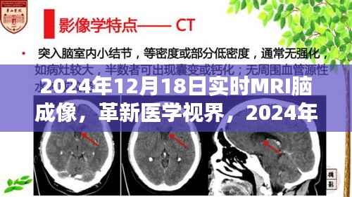 革新医学视界,实时MRI脑成像深度评测与未来展望