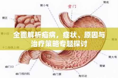 全面解析疝病,症状、原因与治疗策略专题探讨