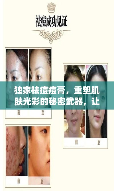 独家祛痘痘膏，重塑肌肤光彩的秘密武器，让你拥有无瑕美肌！